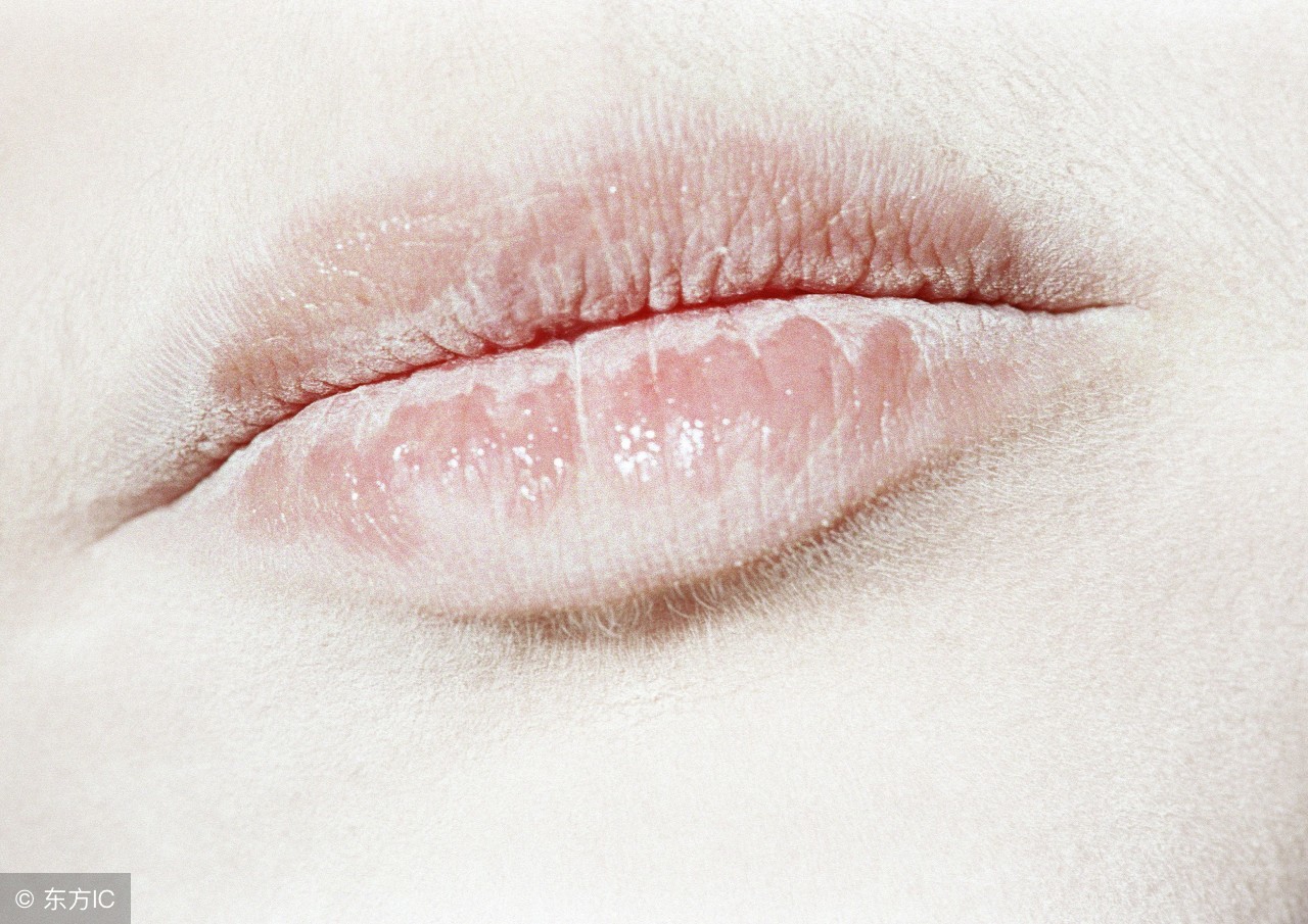 嘴唇干燥缺水怎么解决,嘴唇干燥起皮怎么改善