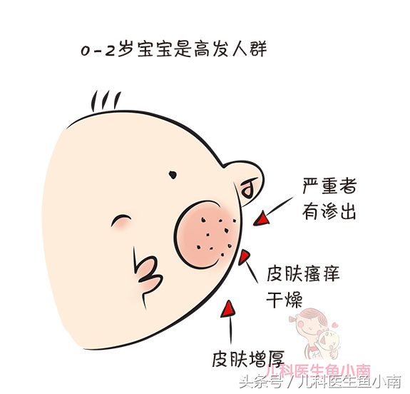 宝宝湿疹不红了但还有小疙瘩痒,宝宝湿疹和热疹的正确护理方法