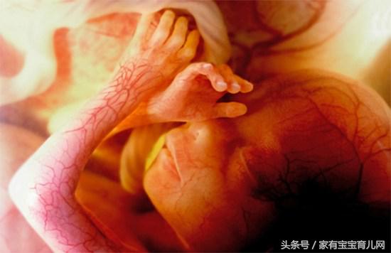 孕期如何祛湿毒,孕期清肠最快的方法