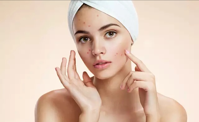 脸上能看出是妇科病吗,姐妹们脸上有各种肌肤问题