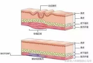 深度剖析医美整形的危害,医美整形该如何避坑呢