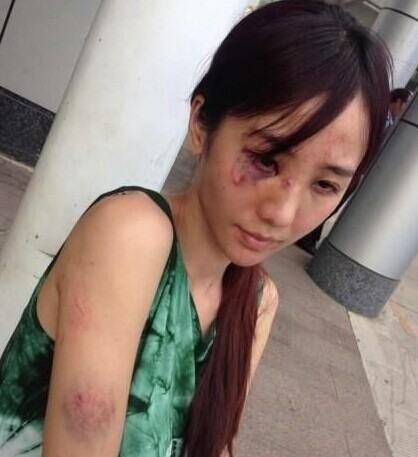 家暴过去几年了怎么处理,家暴如何用法律保护自己