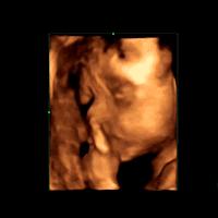 二维彩超三维彩超和四维彩超,划重点完整版免费