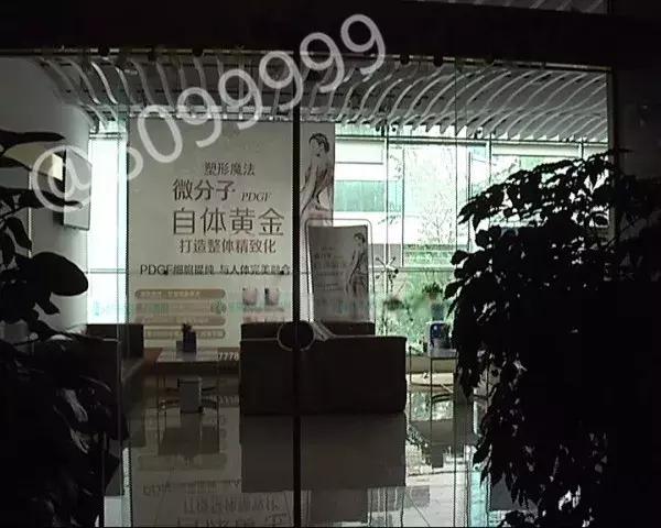 女子植发然后全部脱发,女子斑秃治疗后全秃