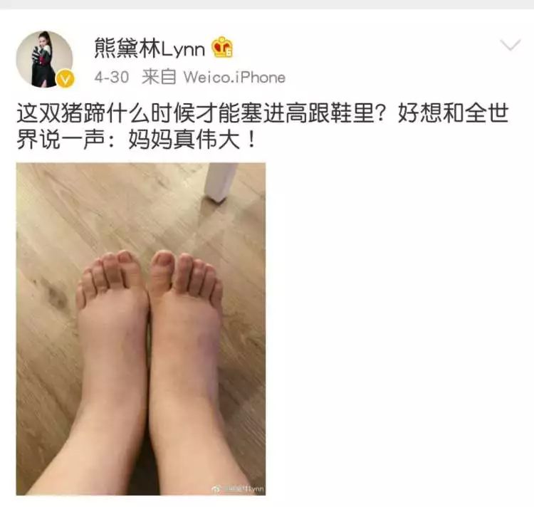 熊黛林产后10天效果,熊黛林产后的身材简直理想状态