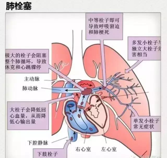 双氧水能治疗伤害,长期使用双氧水会导致什么