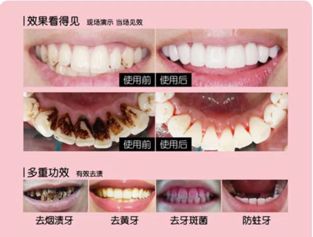 漱口水洁牙慕斯,比牙膏好用的漱口水