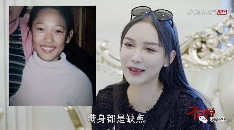 整容是好是坏的辩论,整容好不好辩论