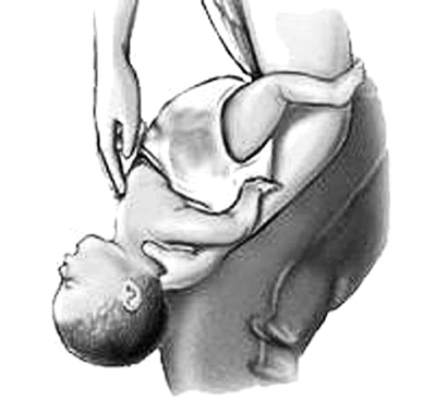 男童卡喉险窒息路过护士60秒救回,男童硬币卡喉公安护送