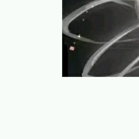 qq照片墙拼图6张图片,qq照片墙拼图9张