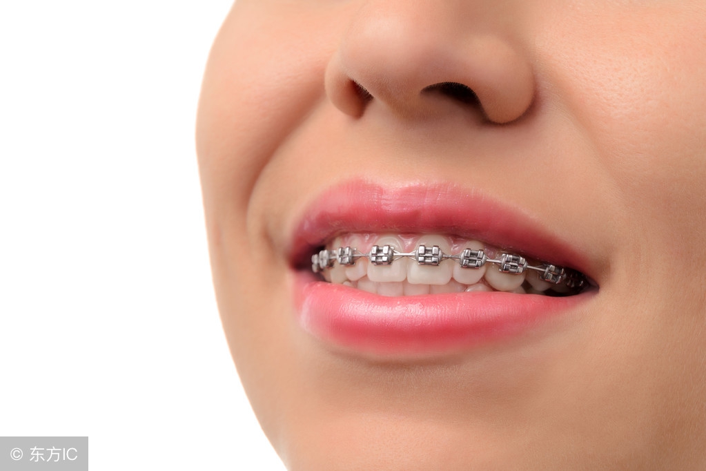为什么牙齿矫正堪比整形,牙齿矫正堪比整容