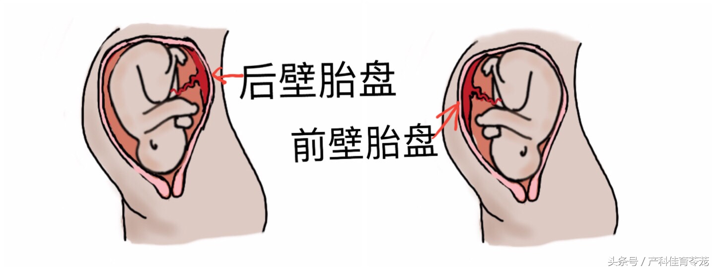 孕期B超数据准确吗,b超医生说的数字