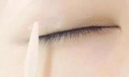 不用动手术也能让眼睛变大的方法,不做手术就能恢复视力