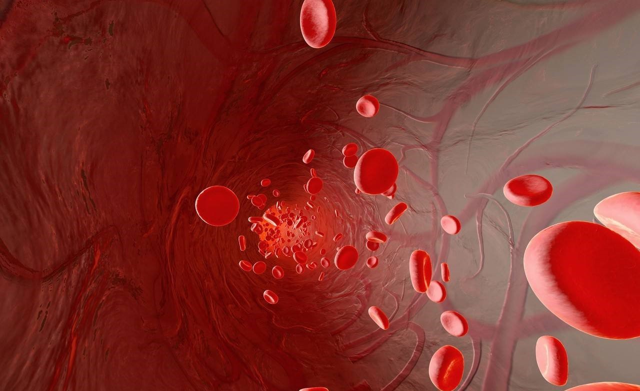 收藏！高血压最有效的治疗方式