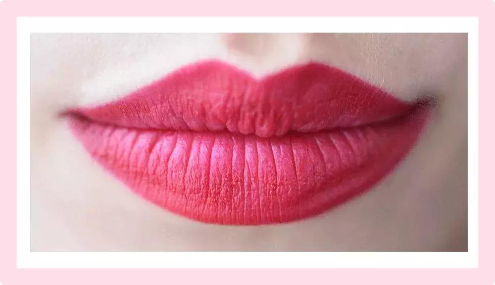 改善深唇纹唇色,改善唇纹最有效的方法医用