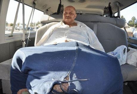 世界“最大”的*丸睾**重达60公斤