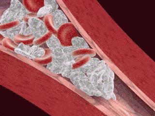 人的血管很明显是怎么回事,经常输液的人如何保养血管