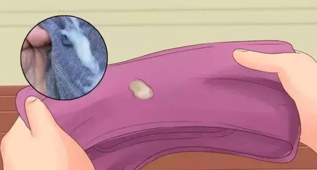 白带多裤子总是湿的怎么办,白带多裤头湿乎乎的怎么可以自愈