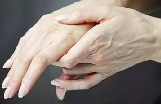 手上青筋怎么治愈呢,可以看到手上的青筋是怎么回事