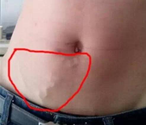 手上青筋怎么治愈呢,可以看到手上的青筋是怎么回事