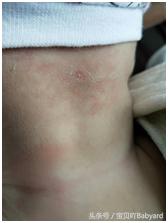 宝宝突然厌食还爱哭,宝宝突然厌食最快的解决方法