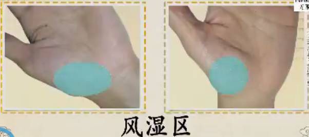 手健康有多重要,手型看健康