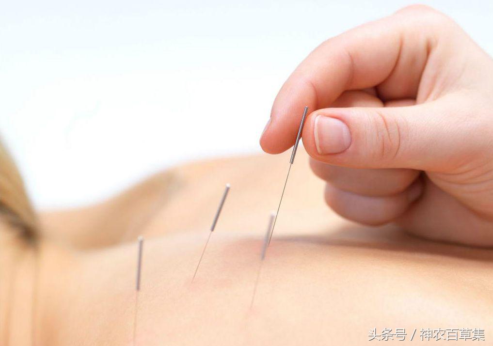 铜人针灸背后的故事,王惟一针灸经典
