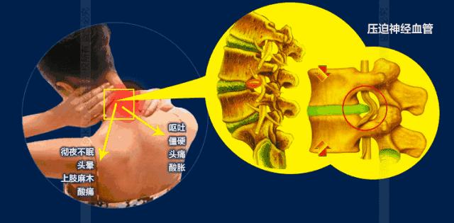 告别颈肩腰腿关节疼,日本治疗创伤性关节炎