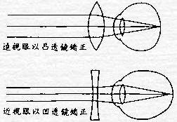 近视科普方案有哪些,近视科普教育方案