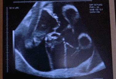 怀孕前三个月注意事项和饮食禁忌,高龄怀孕初期注意事项和饮食禁忌