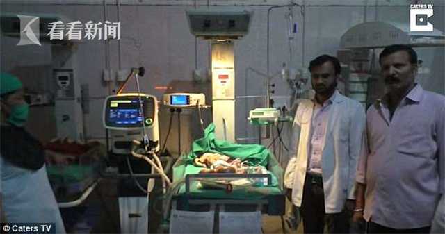 罕见鱼鳞病婴儿,印度塑料婴儿