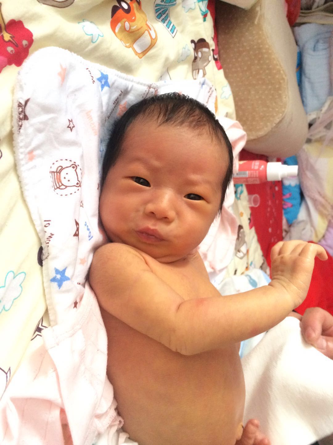 新生儿黄疸应怎么办,新生儿黄疸治不好怎么办