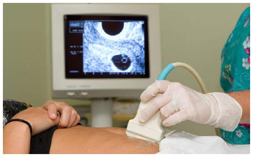 胎儿发育的好坏，B超单上早就已经告诉你，这4个数据你能看懂