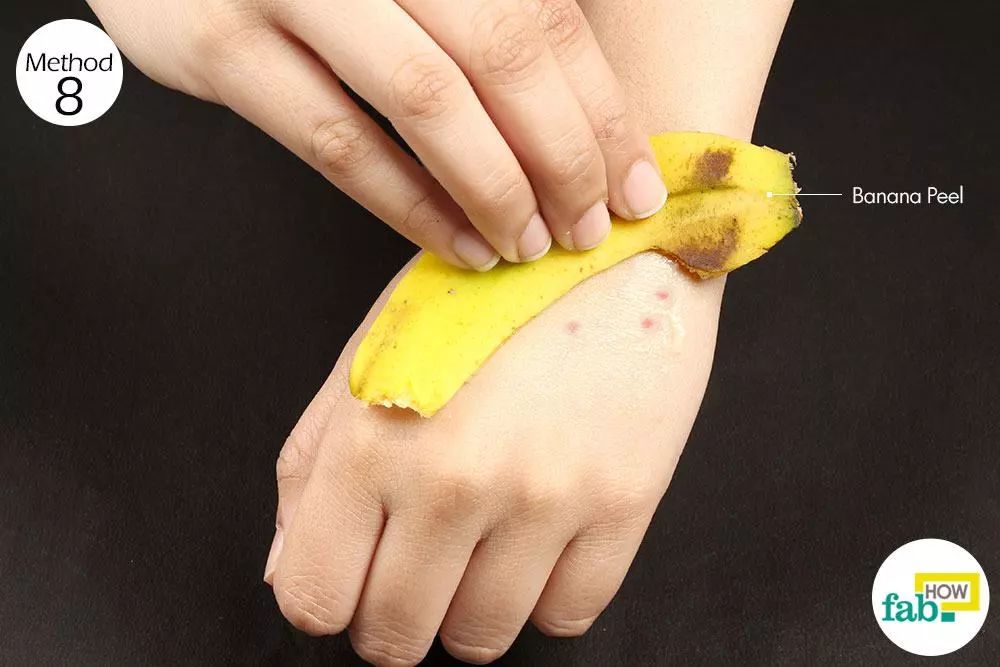 蚊虫叮咬止痒擦药视频,蚊虫咬了怎么消肿止痒用什么药