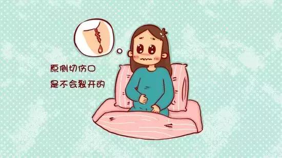 第一次生孩子顺产有侧切,生宝宝顺产侧切要拆线吗