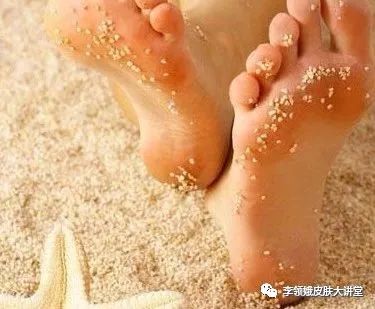 「杏林微科普」真假“香港脚”