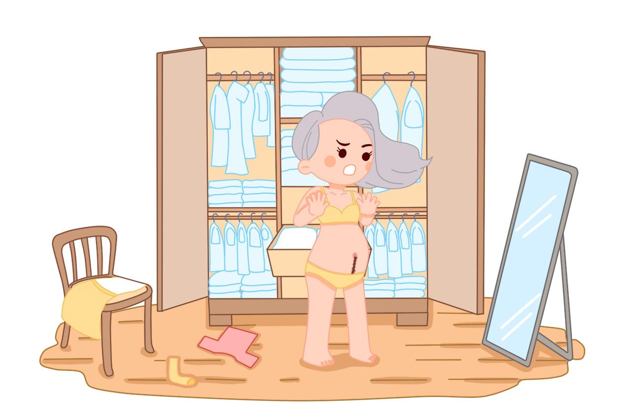 生娃后的妊娠纹怎么去除？困恼的宝妈们快看过来