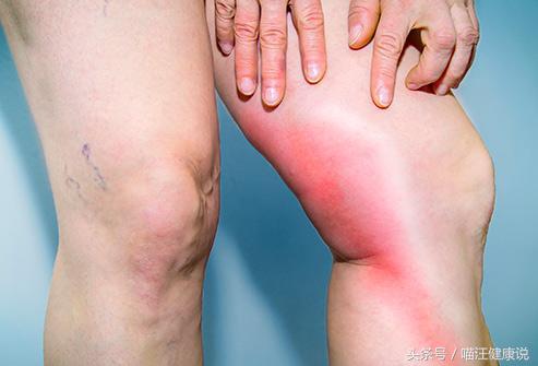 长时间坐对身体的影响,为什么坐时间长了脊椎会不舒服