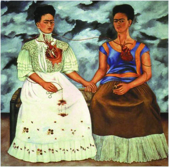 墨西哥女画家弗里达作品受伤的鹿,墨西哥传奇女画家