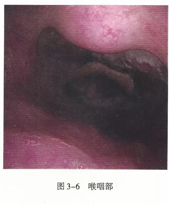 上呼吸道解剖视频教程,呼吸道生理与解剖课件