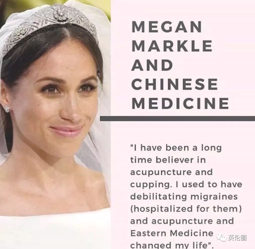 哈里梅根婚前求助中医！歪果仁已经把针灸吹上了天