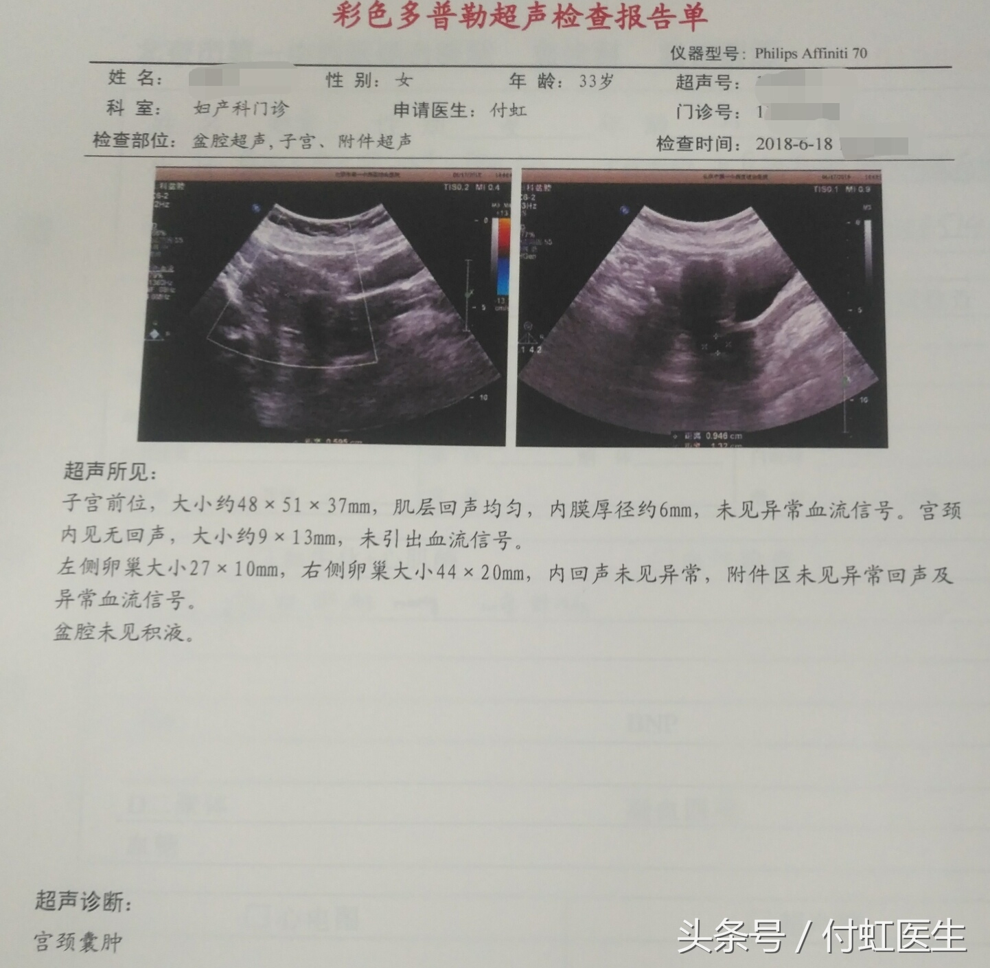 老公只顾着看“世界杯”,二胎妈妈累出了“盆腔炎”!