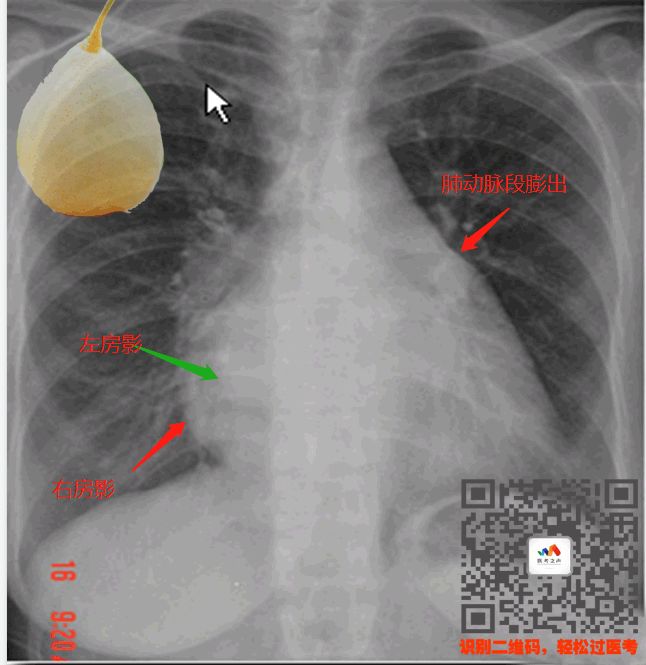 执医技能：X线阅片，全是套路，超简单