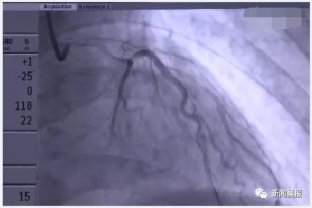 世界“悲”！39岁球迷连续熬夜看球至凌晨，一觉醒来差点……你还敢熬吗？