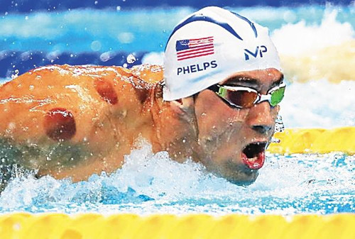 足球队医药箱应备哪些药物,足球队医药箱需要什么配备