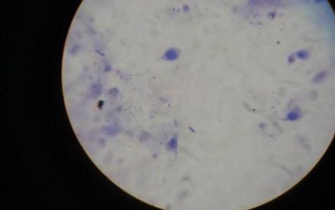 喝生水对身体有什么危害,喝生水会有什么样的后果