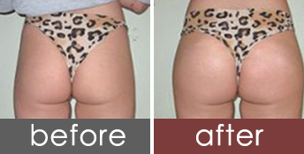 前凸怎能不后翘？内马尔女友同款蜜桃臀Pick一下吧