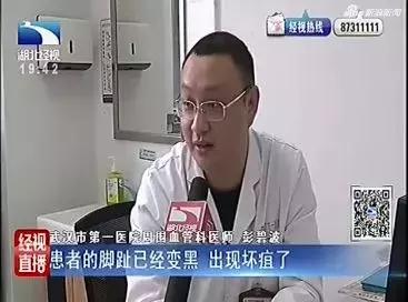 女儿用84消毒液给母亲治脚气,致其脚趾破溃只能截掉!