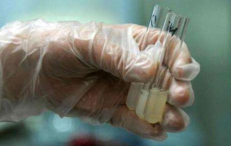 孙老师备孕课第21讲：从种子起提高生命质量：精液液化时间过长者