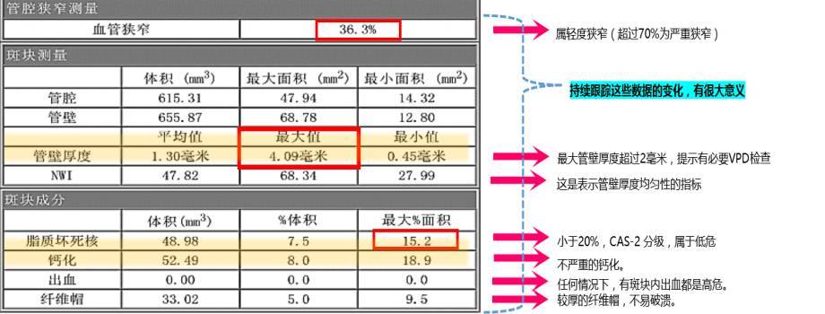 识别易损斑块方法,从了解到熟练五个阶段